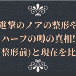 進撃のノアの整形前の顔や箇所はどこ?病院や現在との比較・ハーフの噂の真相まで